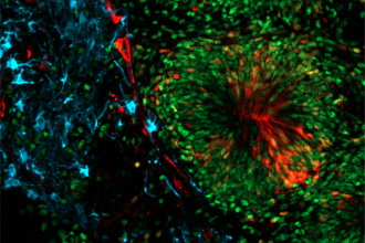 A close-up of an organoid