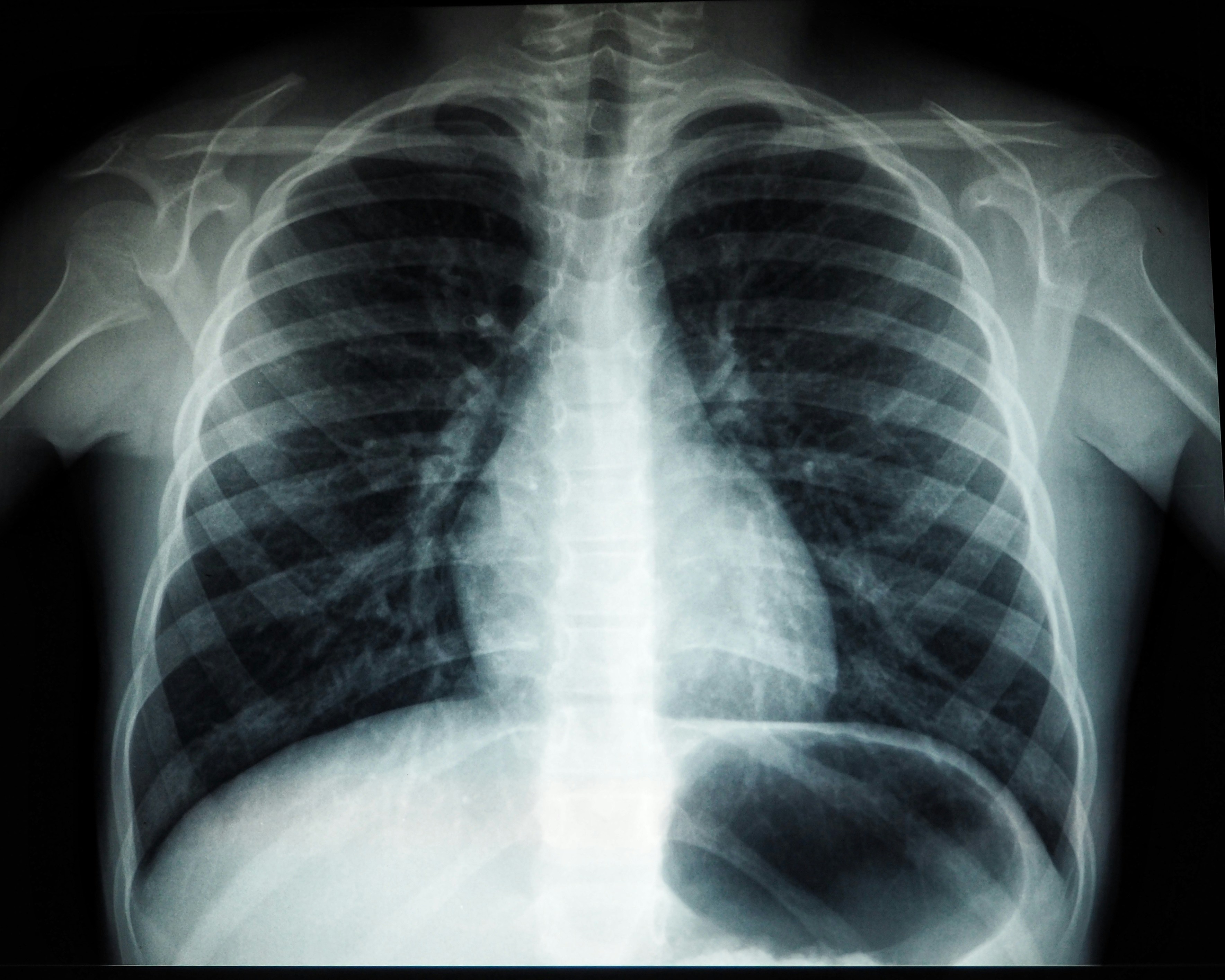 Photo by Umanoide on Unsplash