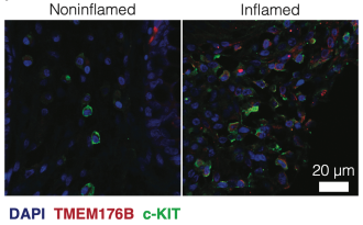 Microscopy images comparing 'quiet' gut tissue and inflamed tissue