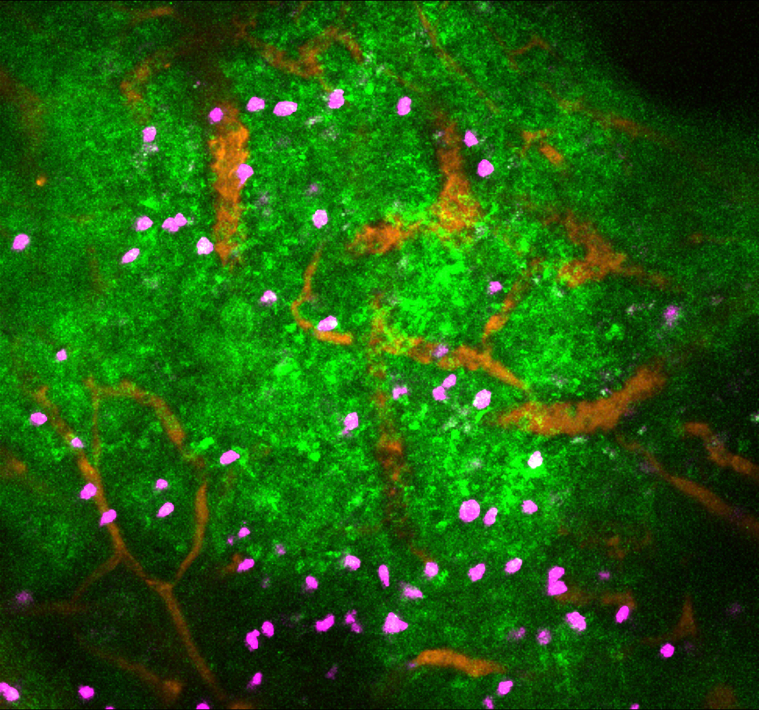 The image shows the impact of sympathetic nervous system activity in immune tissues (lymph node). Lymphocytes (purple) can be seen amongst blood vessels (orange) and the calcium signalling (green) that results from noradrenaline neurotransmitter release and causes immune cells to stop moving. Credit Scott Mueller