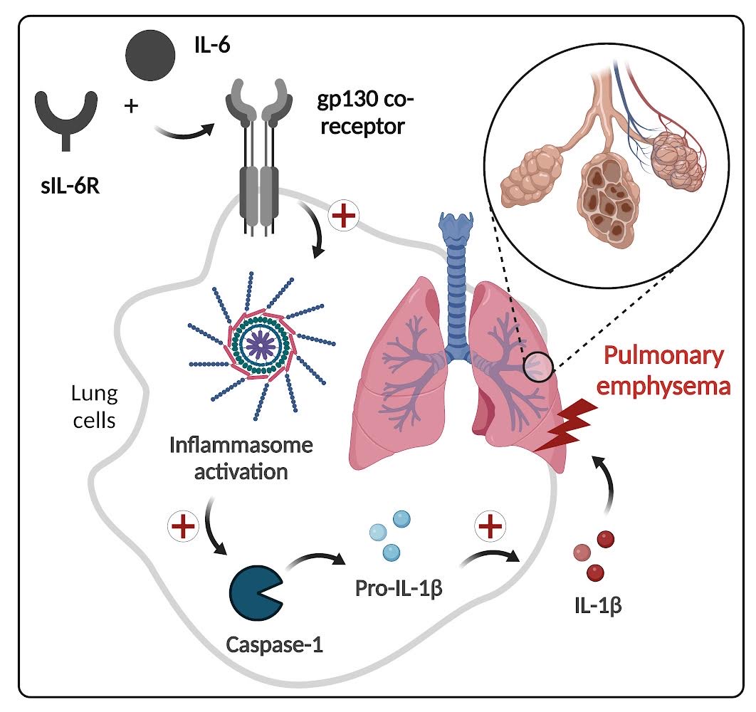 Isolating the molecules that trigger emphysema Scimex