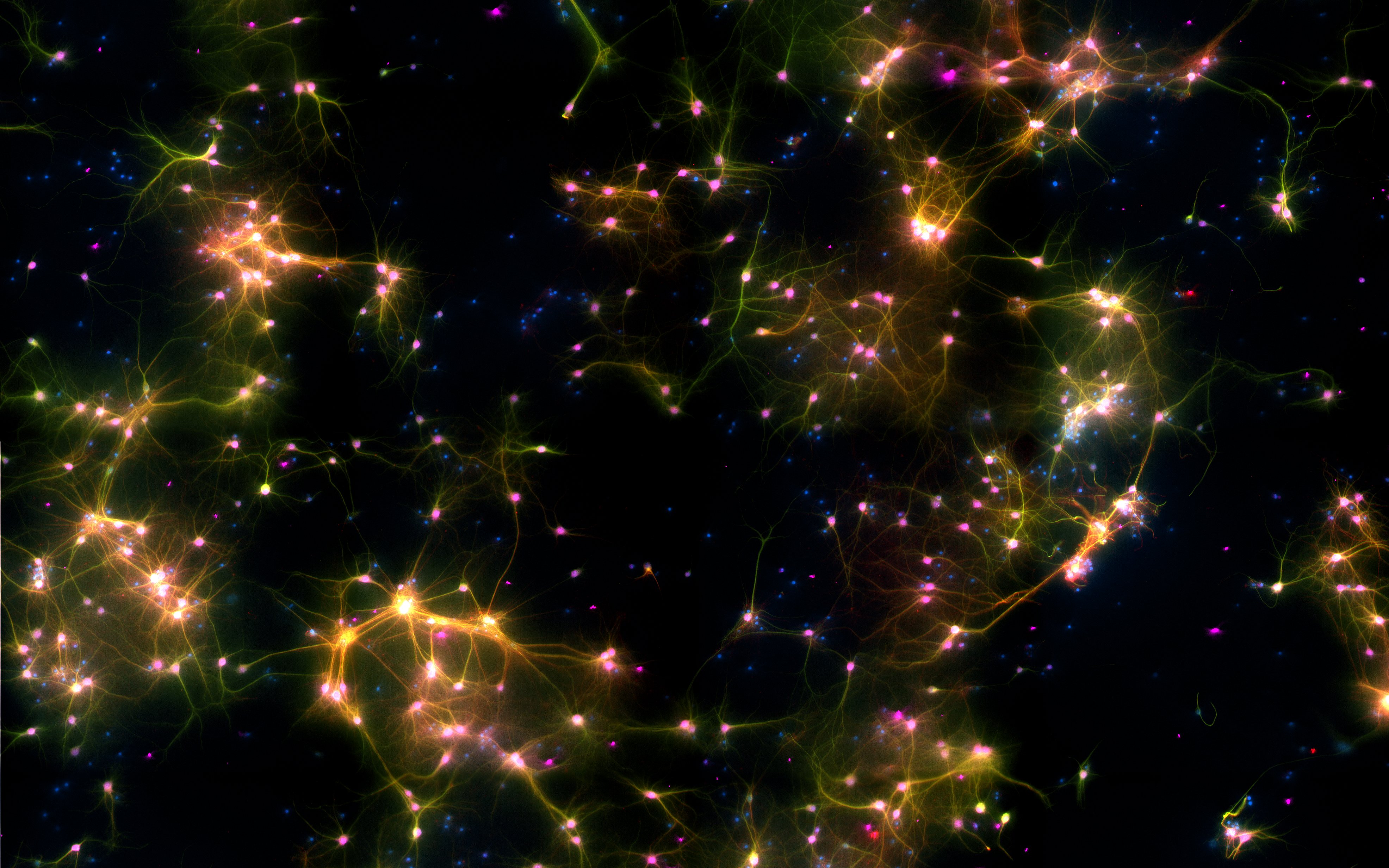 Dishbrain under the microscope. A microscopy image of neural cells where fluorescent markers show different types of cells. Green marks neurons and axons, purple marks neurons, red marks dendrites, and blue marks all cells. Where multiple markers are present, colours are merged and typically appear as yellow or pink depending on the proportion of markers. Credit Cortical Labs