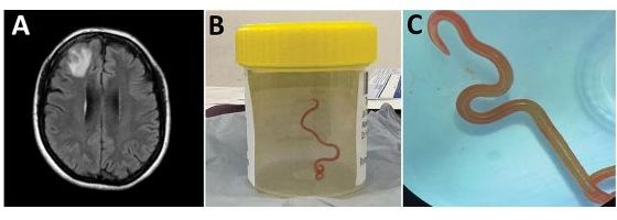 Image credit: Hossain, M. et al. / Centers for Disease Control and Prevention, USA https://wwwnc.cdc.gov/eid/article/29/9/23-0351-f2