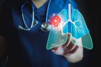 Medical researchers at Flinders University have uncovered an important clue that could help doctors better predict what happens next for people with advanced lung cancer when their first treatment fails.
