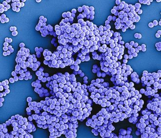 At-home tests sold to the public to assess their gut health give vastly different results depending on the brand, according to US researchers who say standardised protocols around these products are needed to improve their accuracy. The researchers used 21 direct-to-consumer gut testing services from seven different companies to test samples from the same human poo. Results differed between the tests, with some reporting the sample had high levels of potentially diarrhoea-causing Clostridium gut bugs while others detected no levels. Even tests from the same company were not consistent, the researchers say, with one company reporting the sample as unhealthy with one test, but healthy with two other tests of the same sample.