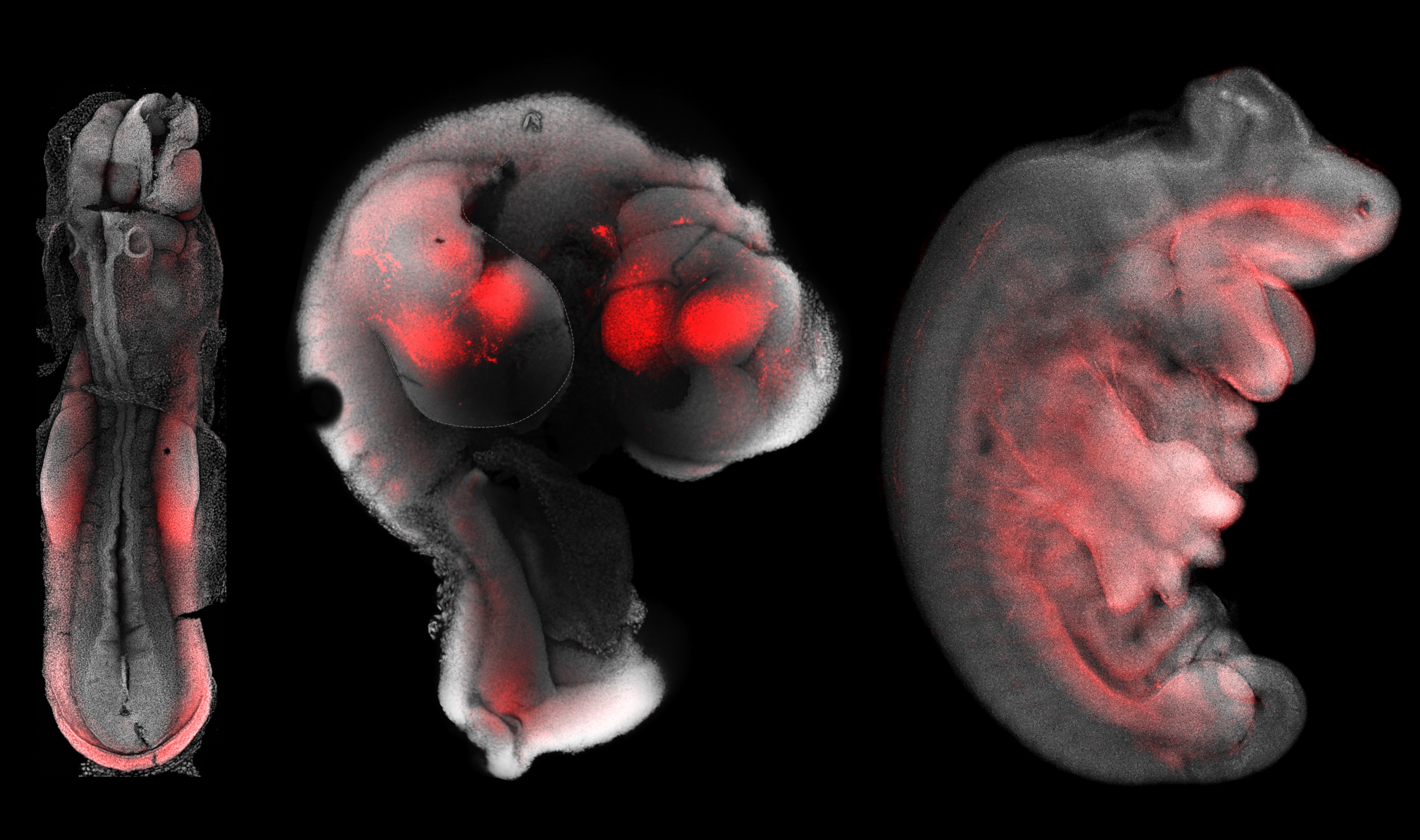 Progression of forelimb development in a dunnart embryo over three days. Credit: Dr Axel Newton
