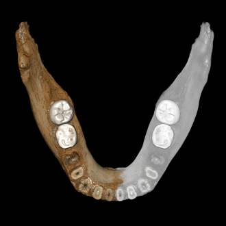 Top-down view of virtual reconstruction of the Xiahe mandible 