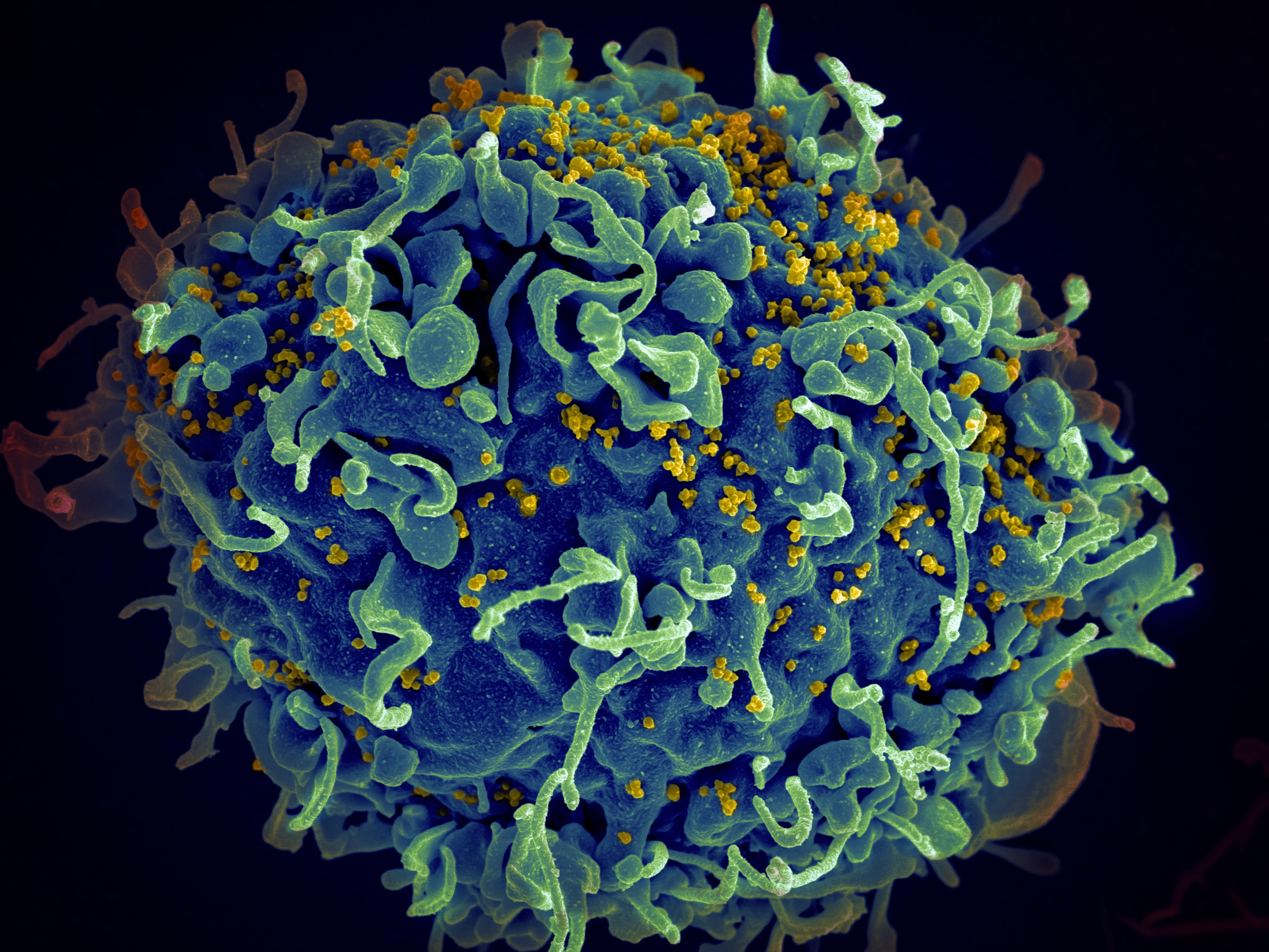 HIV, the AIDS virus (yellow), infecting a human cell. Photo by National Cancer Institute on Unsplash