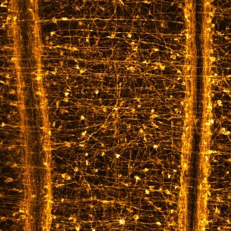 Confocal image of the nerve net of the sea anemone Nematostella vectensis