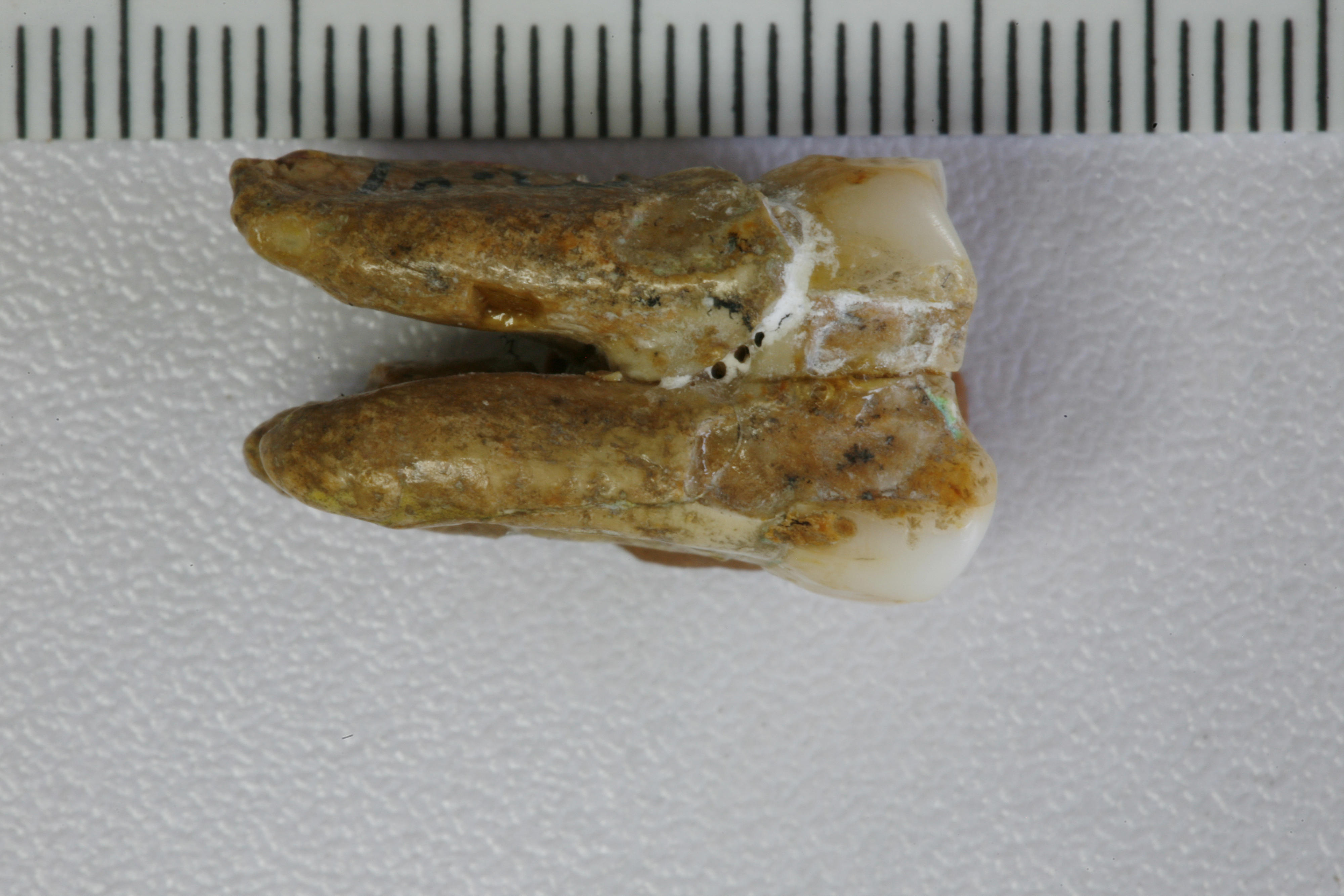 The Zhoukoudian tooth, ZKD (PA69) is from layers 8-9 of the Zhoukoudian site. Credit: Qiaomei Fu, Institute of Vertebrate Paleontology and Paleoanthropology, Chinese Academy of Sciences (fuqiaomei@ivpp.ac.cn)