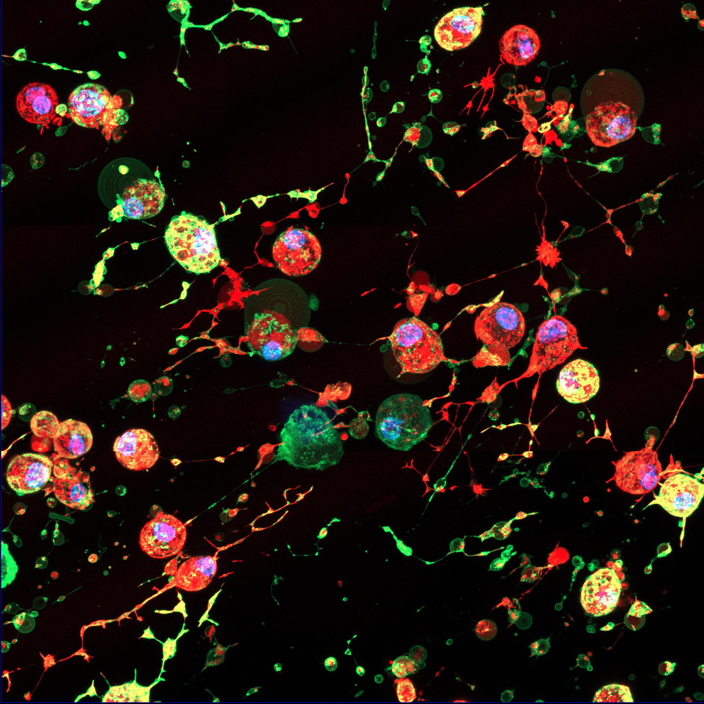 Dead cells after the self-destruction and fragmentation process. The large green areas are the “eat me” signals which alert immune cells to kick-start clean-up and recycling process, while the small green circles are the “Footprint of Death” F-ApoEVs left behind by the dying cell. 