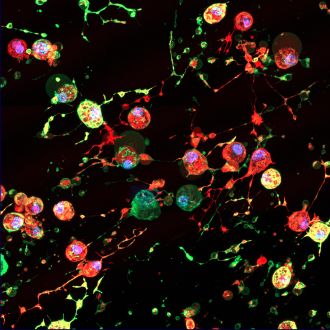 Scientists at La Trobe University have discovered a previously unknown way viruses could spread around the body, potentially paving the way for more effective drug development.