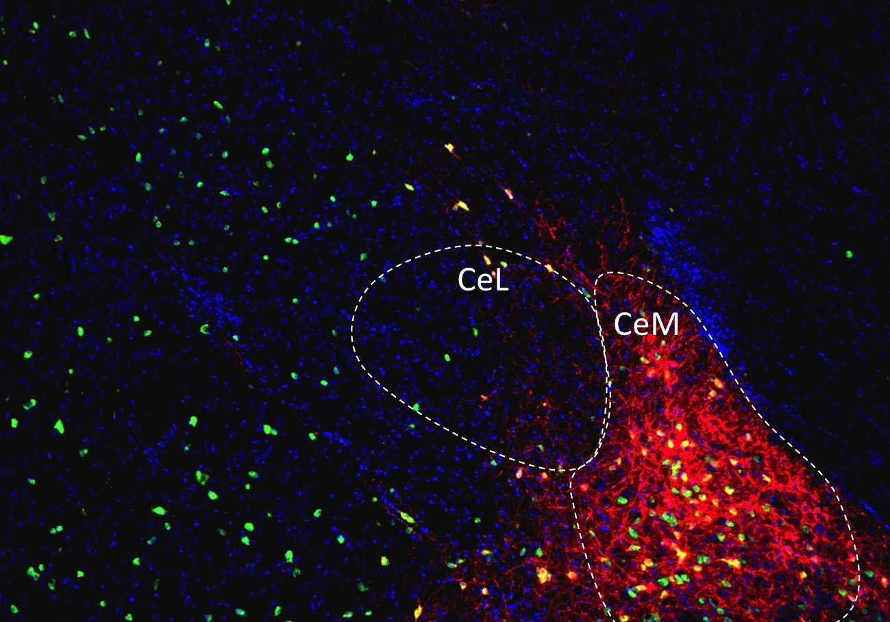 Fluorescence microscopy image of nerve cells in the medial nuclei of the central amygdala (CeM), which produce the molecule NPY (red) in response to stress. Credit: Garvan Institute / published in Cell Metabolism