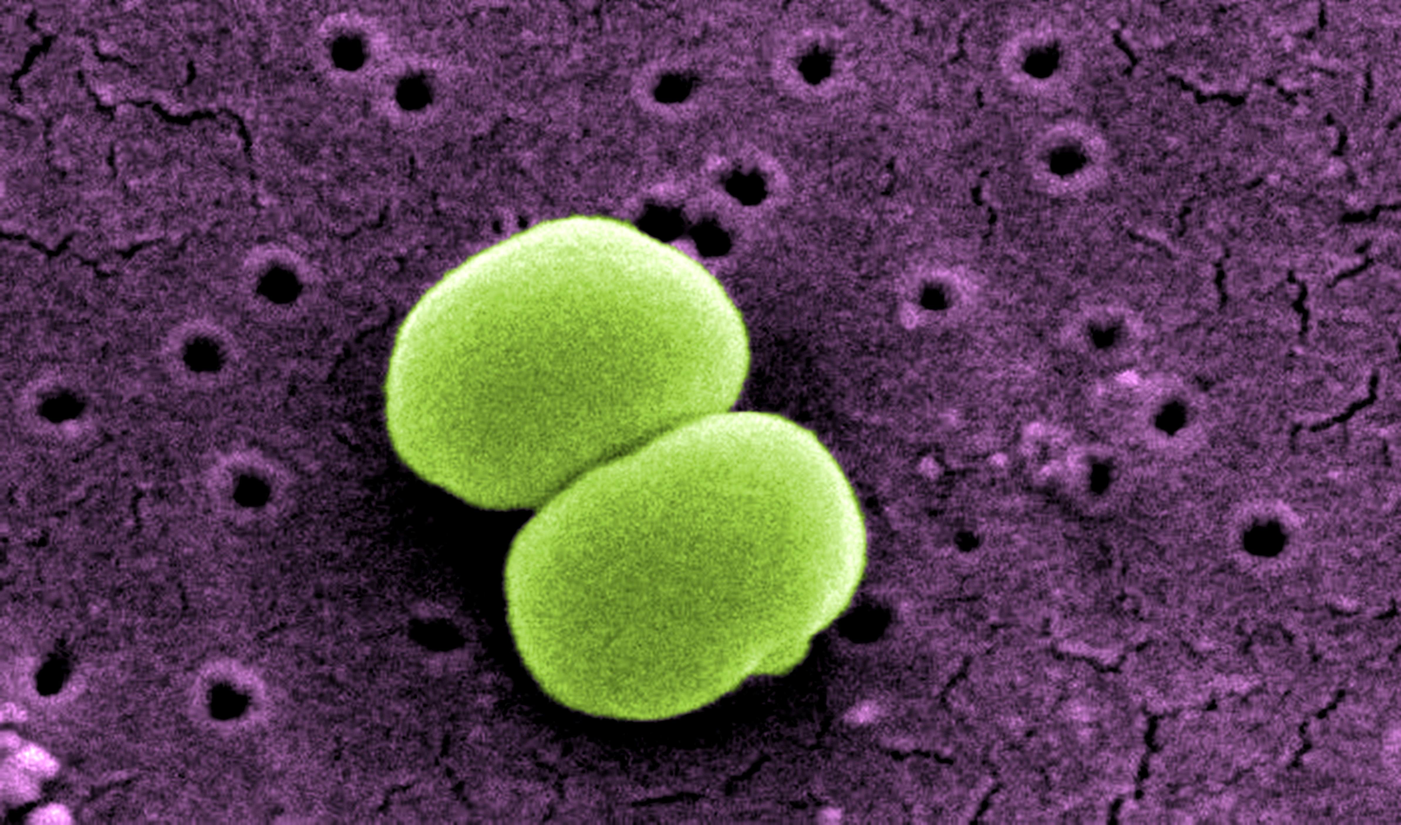 two staphylococcus epidermidis bacteria