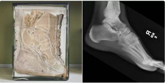 Cross-section of elephant foot with human foot x-ray