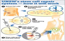 UNSW’s stem cell repair system - how it will work 