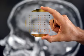 Phenotype Analyzer Chip 2