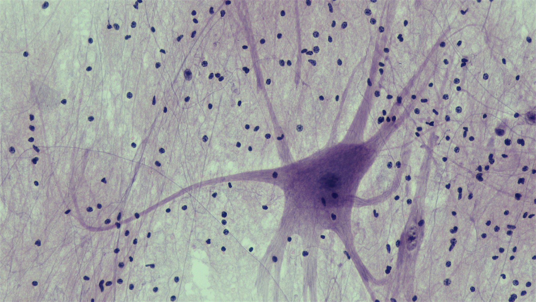 "Nervous Tissue: Spinal Cord Motor Neuron" by bccoer is marked with CC0 1.0.