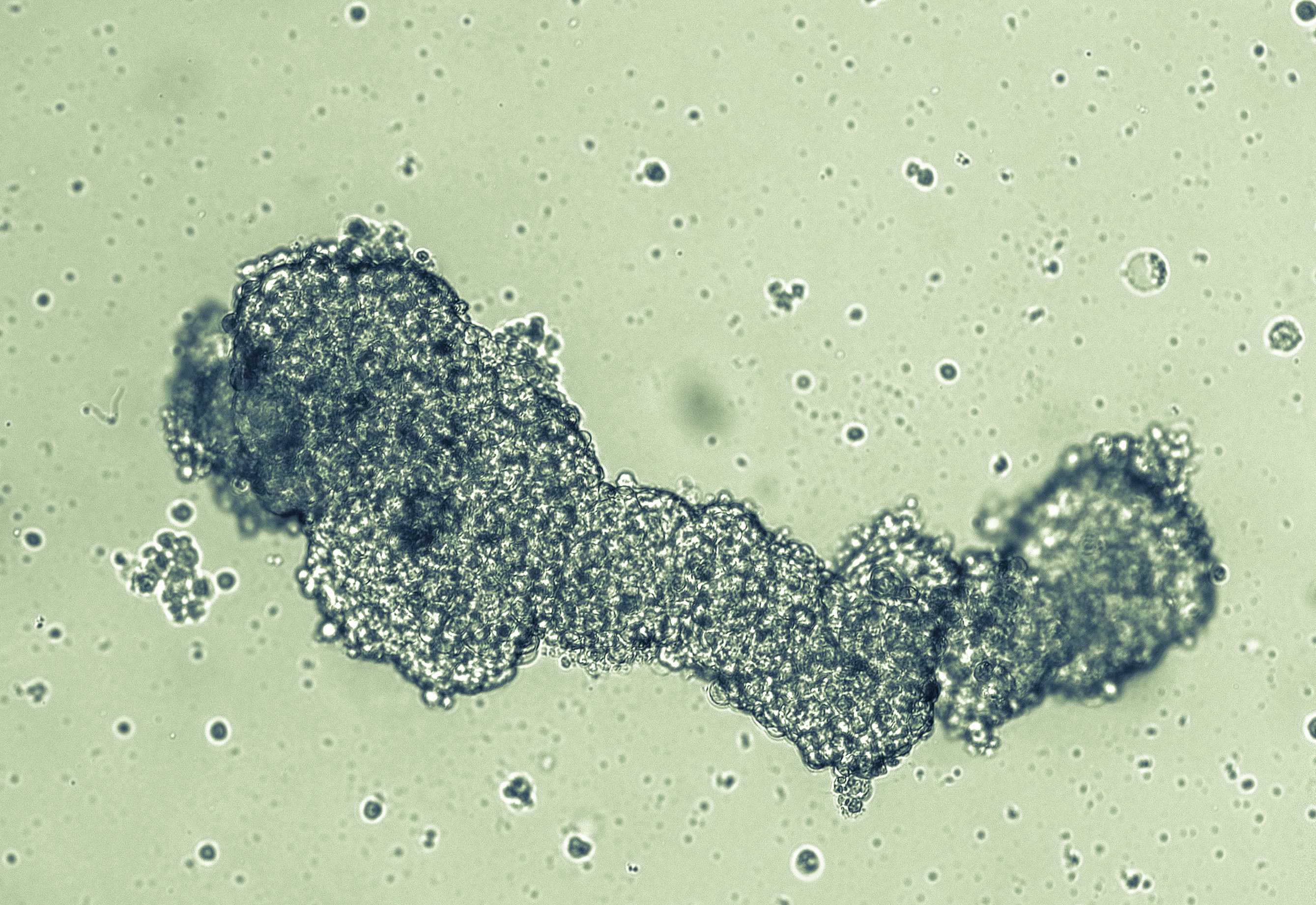 Spheroids of glioblastoma cell culture. By sergunt Adobe Stock images