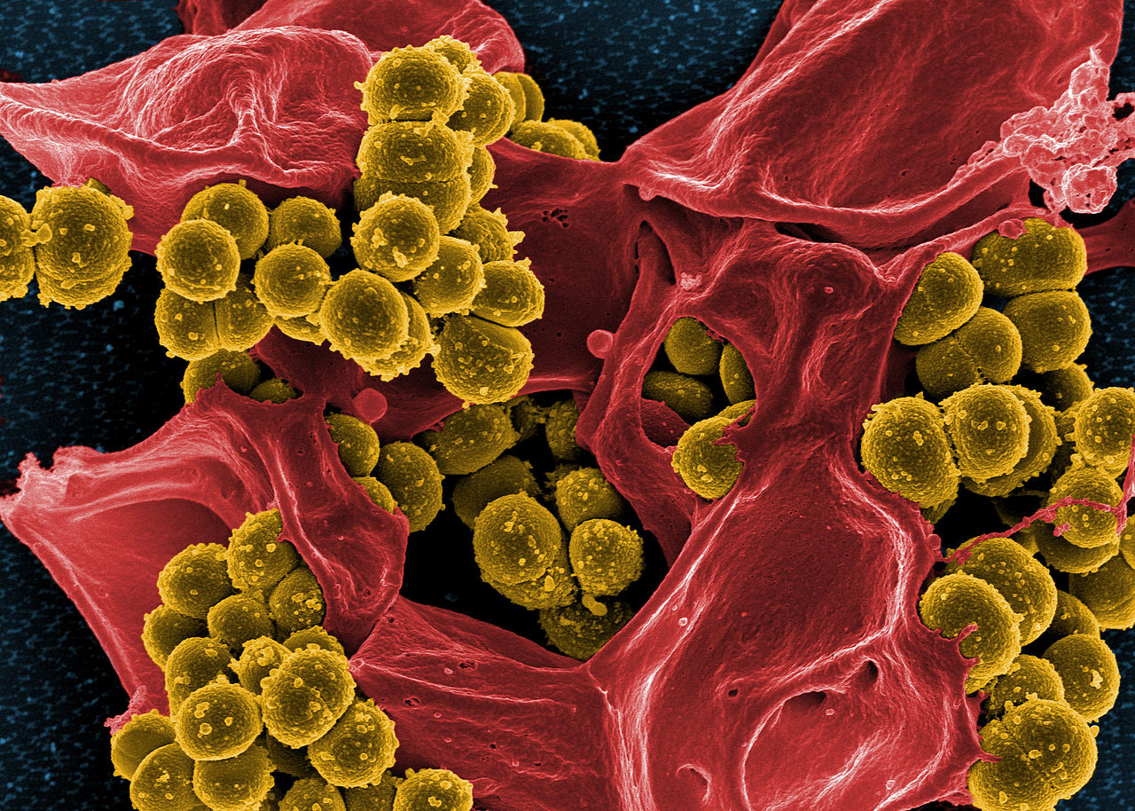 Scanning_electron_micrograph_of_Methicillin-resistant_Staphylococcus_aureus_(MRSA)_and_a_dead_Human_neutrophil By NIAID_Flickr CC BY 2_0