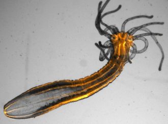 Fluorescent wide-field image of an adult Nematostella vectensis