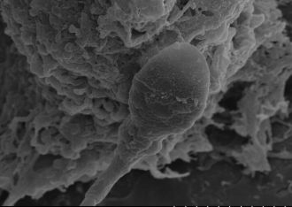  Navigational abilities of sperm are negatively impacted by a lack of gravity.