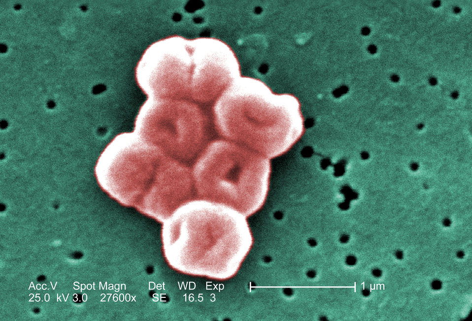 A highly magnified cluster of Acinetobacter baumannii bacteria, which uses a protein pump to resist the powerful hospital-grade antiseptic, chlorhexidine. Credit: Public Health Image Library