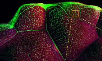 Micro-X-ray fluorescence showing heavy metal in kale. 