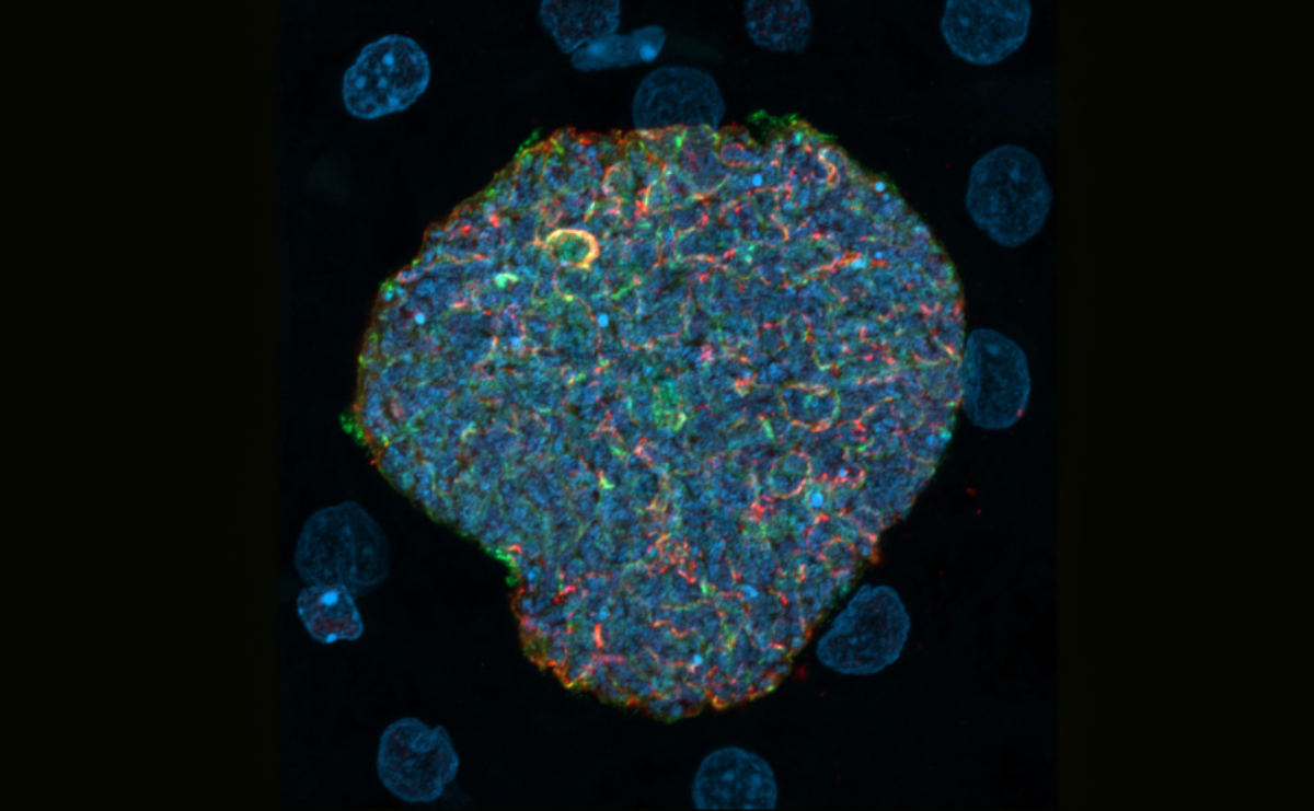 A late liver-stage malaria parasite growing inside an infected liver cell (hepatocyte), expressing different antigens for immune education (red and green). DNA from the parasite (center) and neighboring uninfected liver cells (smaller circles) are shown in blue.  Credit: WEHI