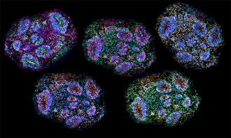 A composite mosaic of sections of an organoid immunolabelled for differ