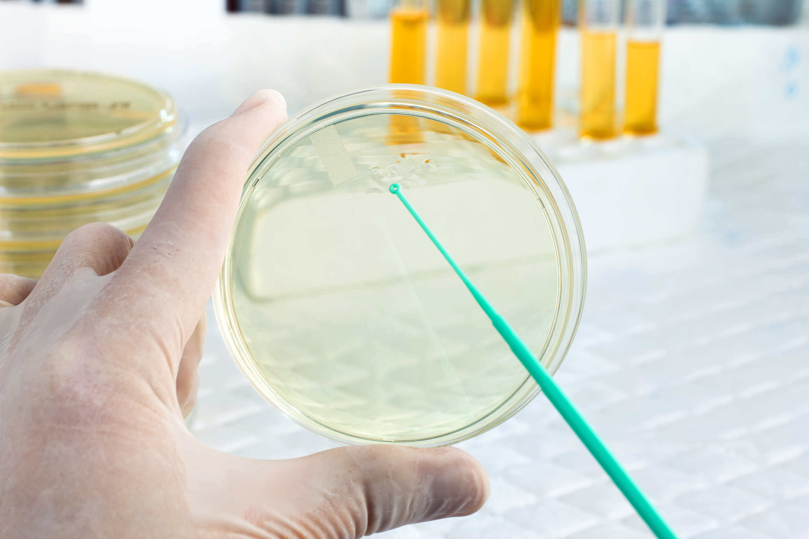 PHOTO: Lab image/Dreamstime