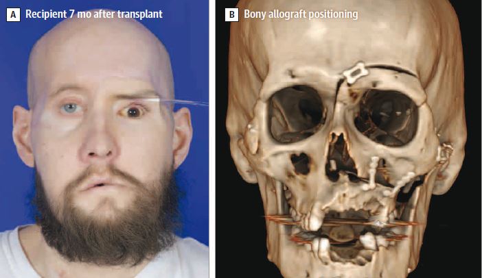 JAMA / Ceradini, D.J., et al.