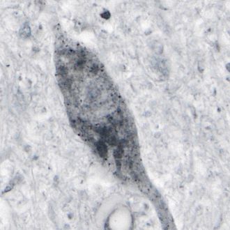   Abnormal SOD1 protein detected in human spinal cord tissue 