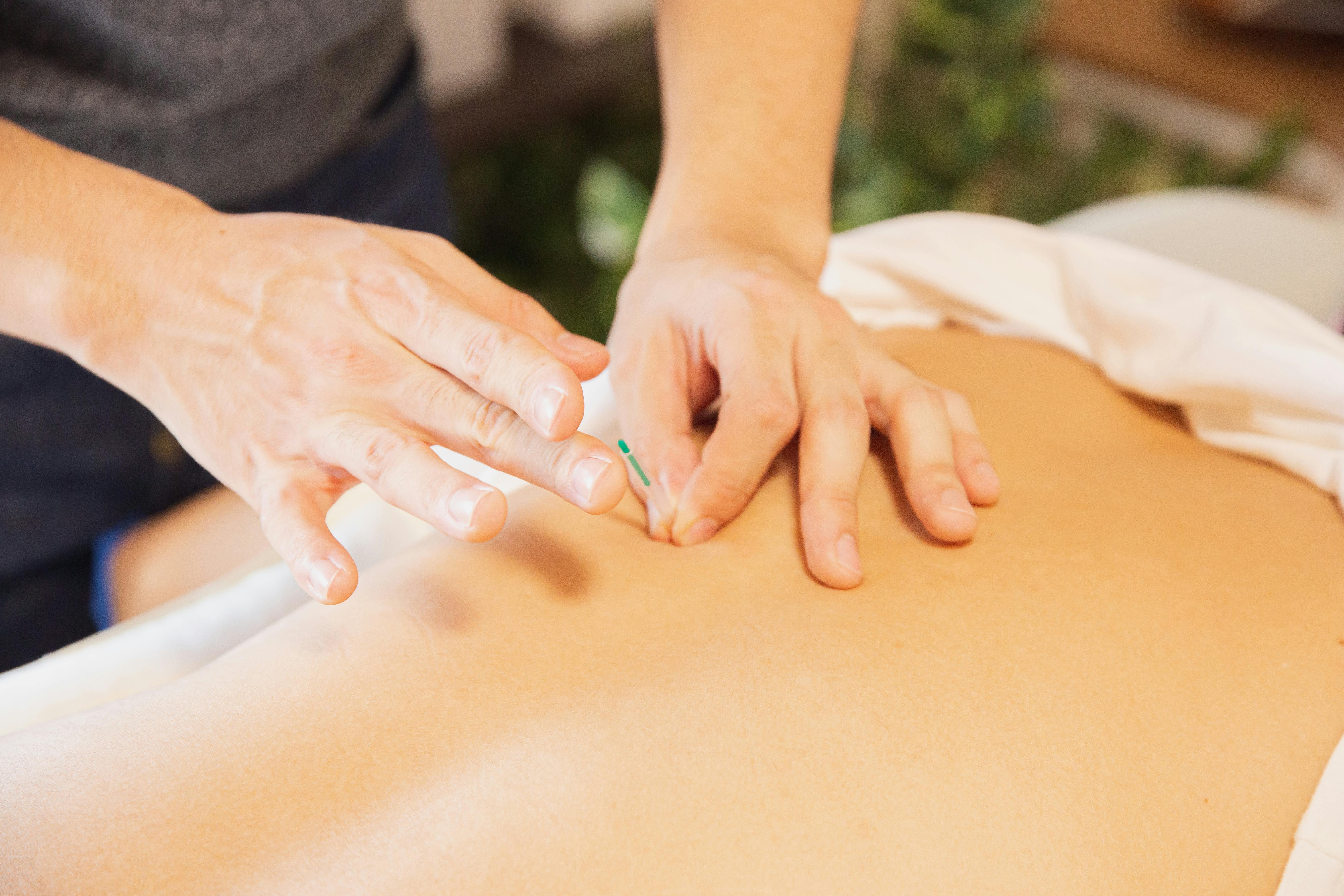 CC-0. https://www.pexels.com/photo/therapist-treating-patient-with-needles-during-procedure-of-alternative-medicine-5473180/