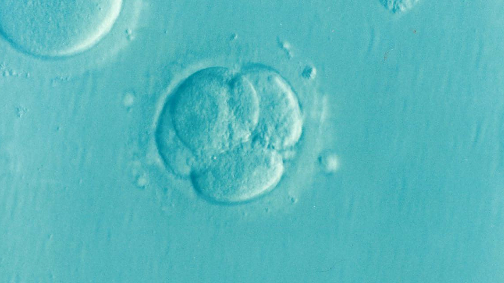 CC-0. https://picryl.com/media/embryo-ivf-icsi-5aacd4