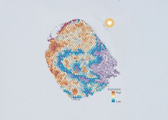Tumour cross section 