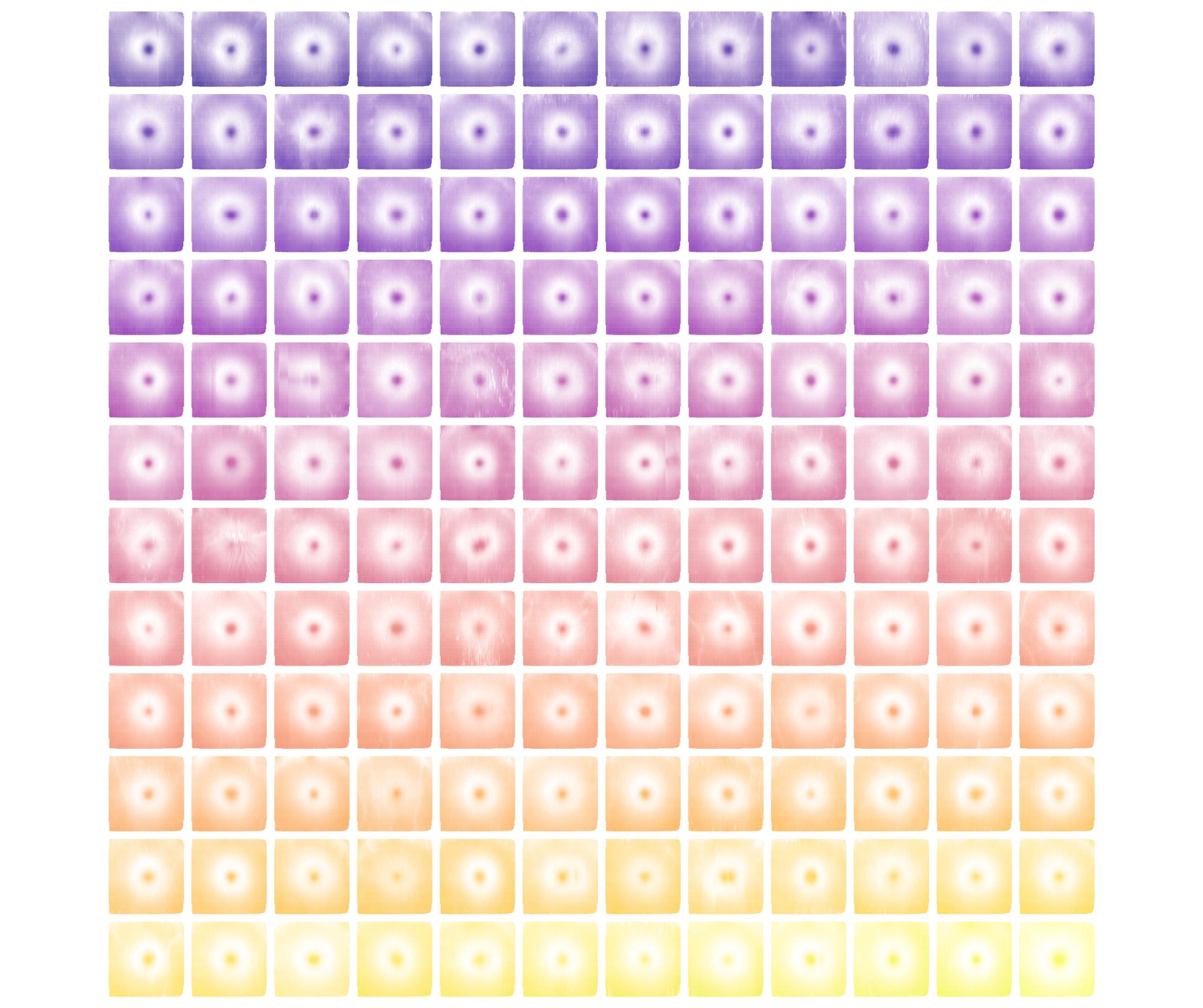 Multiple retinal maps of single eyes with white indicating where the retina is thickest and coloured areas representing thinner regions of the retina. The research identified 294 genes influencing the contours of these retinal maps and pinpointed specific areas of the maps linked to disease. Credit: WEHI