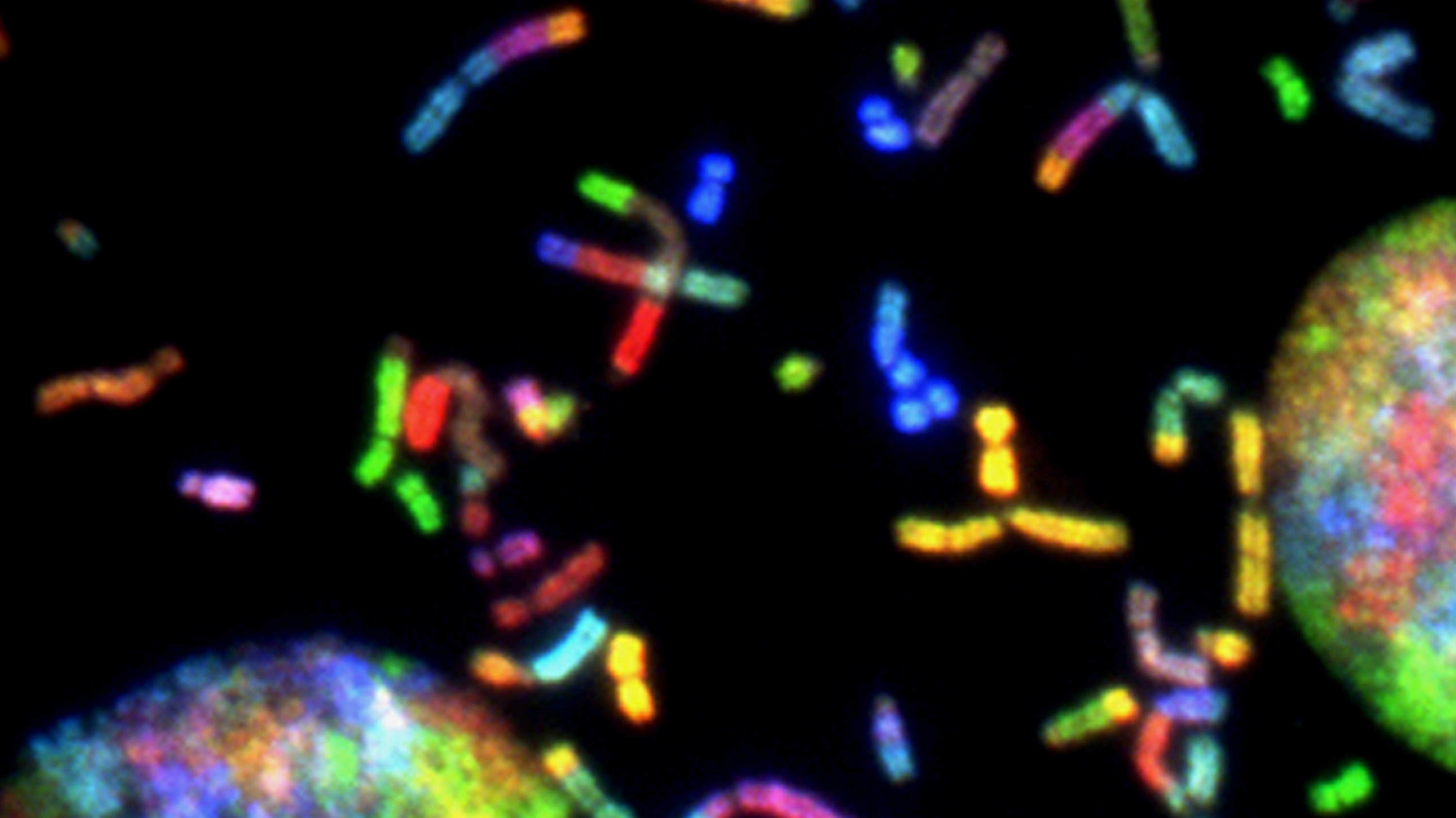 Brain Cancer Chromosomes. Created by Thomas Ried, 2014