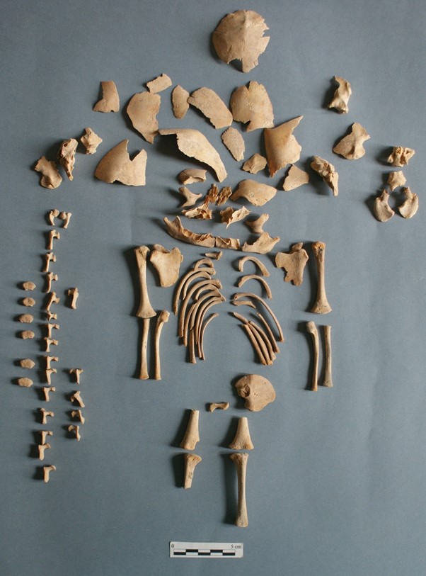 Remains of individual “CRU001”, who the researchers discovered had Down syndrome. The remains were found at a site in Spain dating to the Iron Age. Photograph from the Government of Navarre and J.L. Larrion.