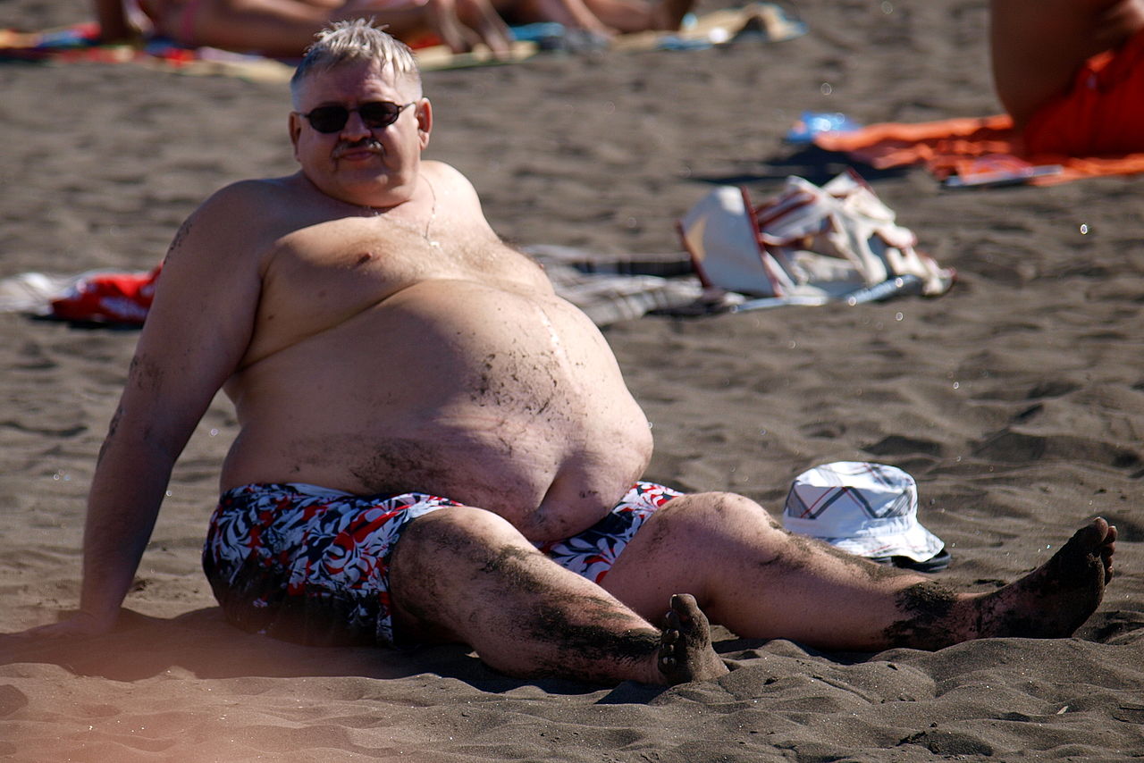 At_the_beach_-_male_abdominal_obesity By Tibor Végh - Tenerife 2010 124.JPG, CC BY 3.0