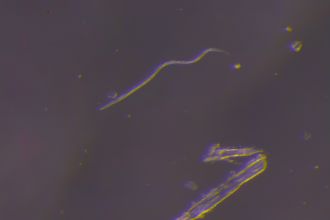 Worm - nematode - under microscope