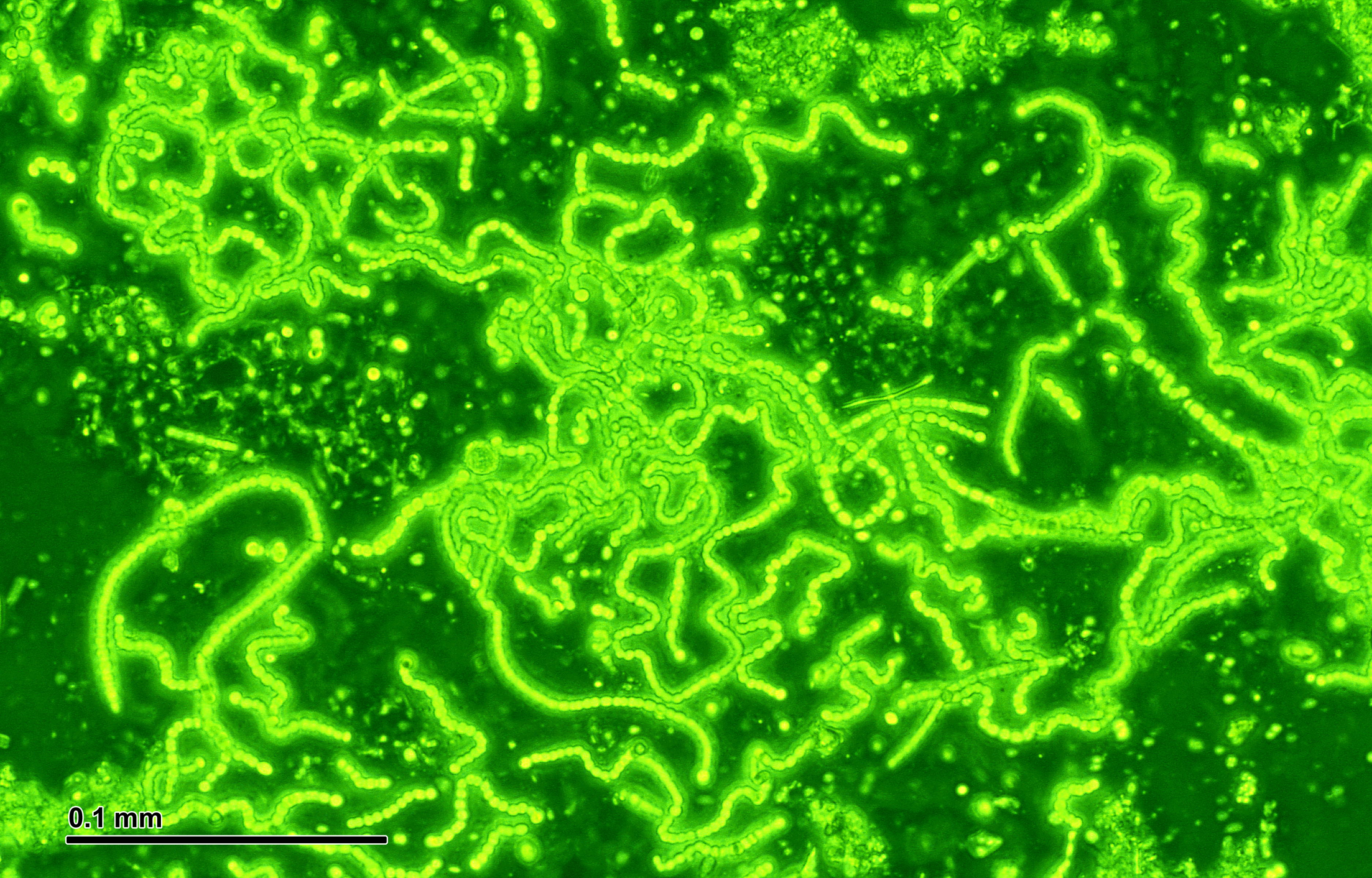 Cyanobacteria - Doc. RNDr. Josef Reischig, CSc., CC BY-SA 3.0 <https://creativecommons.org/licenses/by-sa/3.0>, via Wikimedia Commons