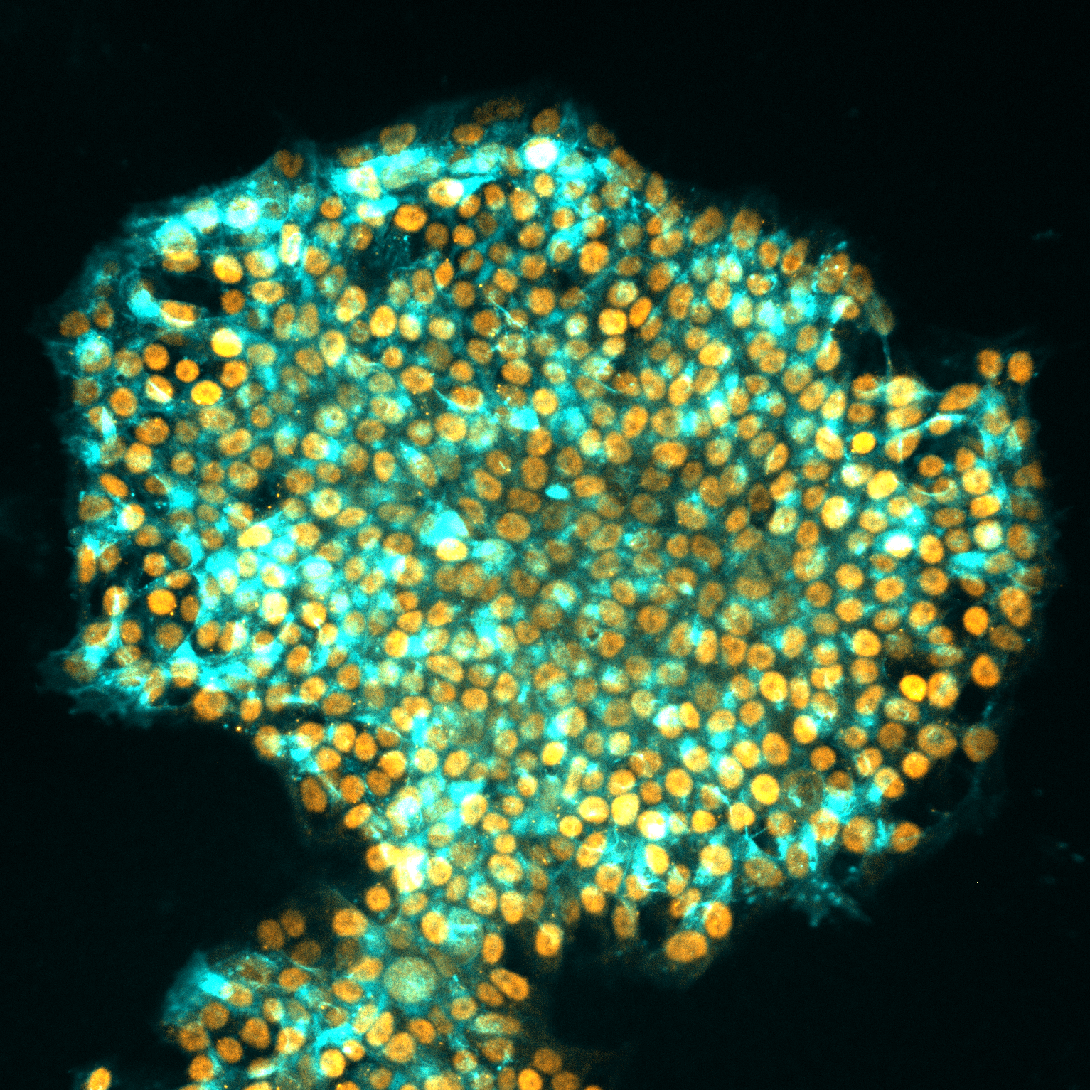 Caption: “Human iPS cells”  Credit: “Jia Tan, Polo laboratory”