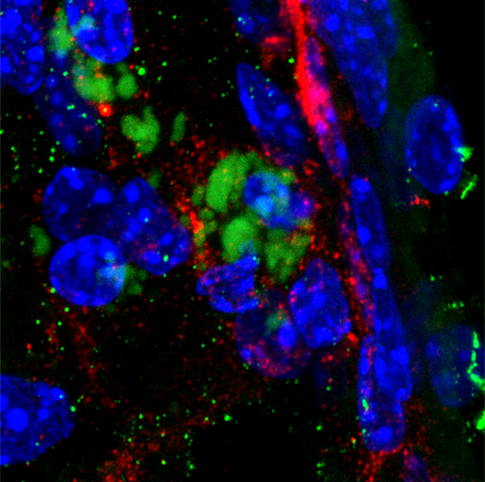The bacterium Chlamydia pneumoniae (green) in the olfactory bulb region of the front of the brain. Beta amyloid peptide (red) accumulates around the bacteria. Blue indicates nuclei of cells of the brain.