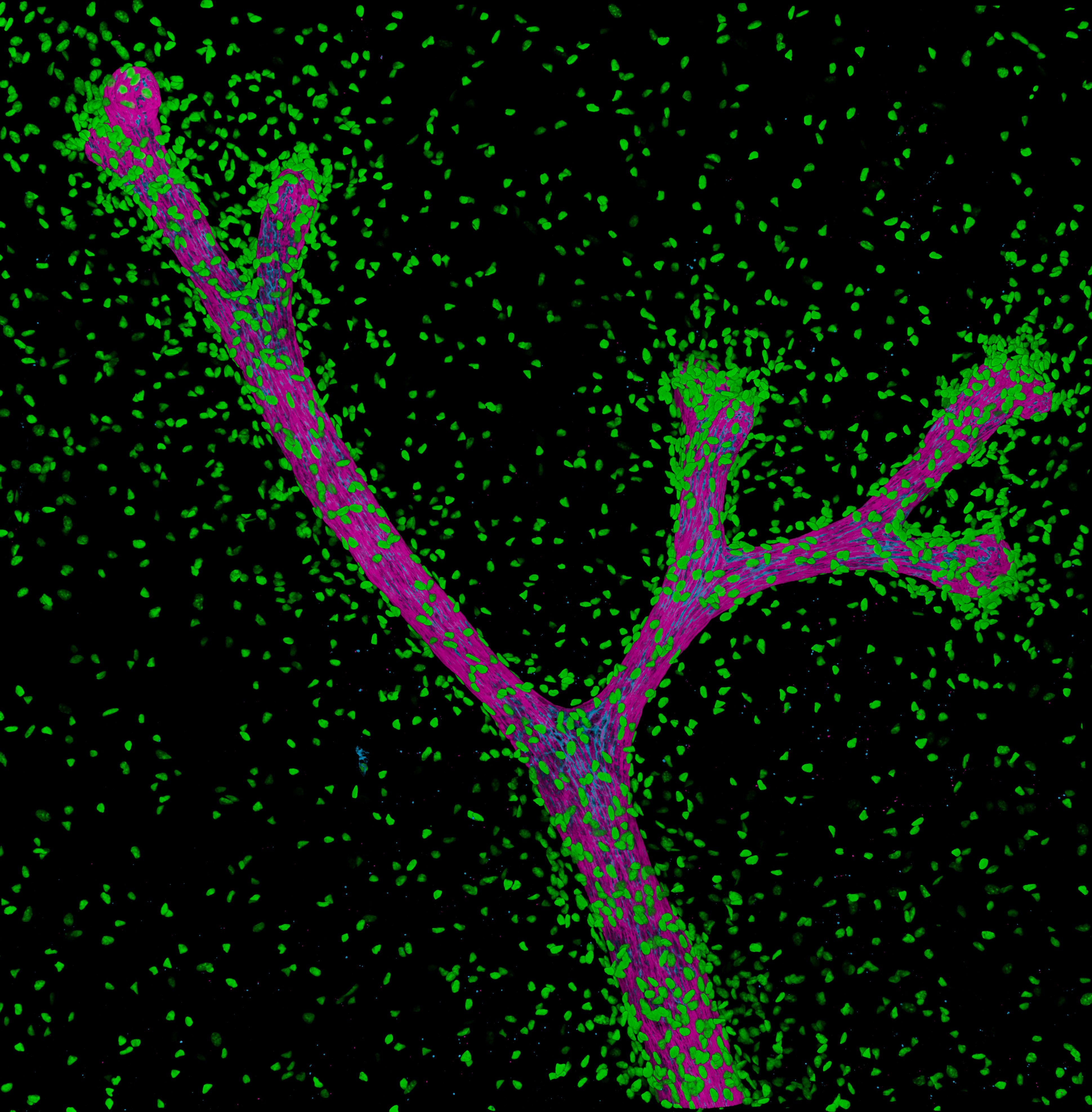 A 3D image of mouse breast tissue, showing fibroblasts (green). Credit: WEHI