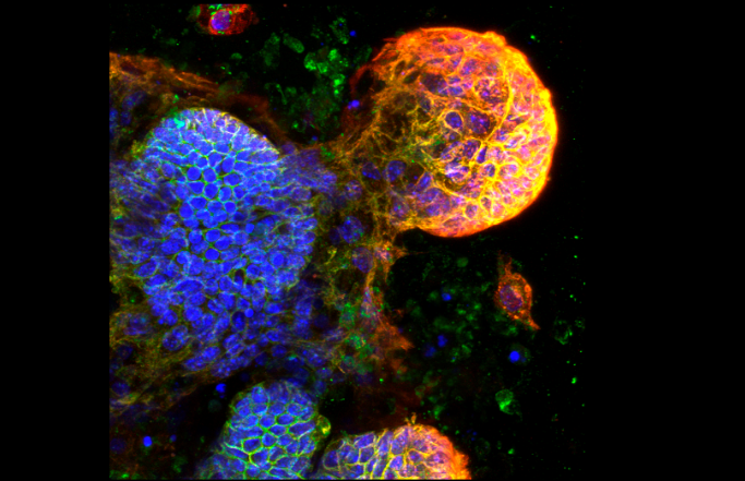Crypts and buds in the small intestine and colon. Credit: Dr Maree Faux, WEHI