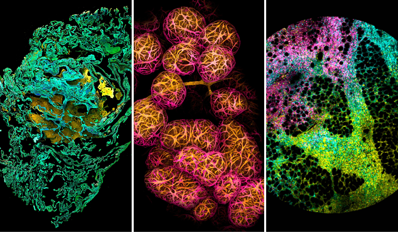 Some of Australia’s most stunning scientific images have been unveiled, with the launch of WEHI’s Art of Science exhibition. Credit: WEHI