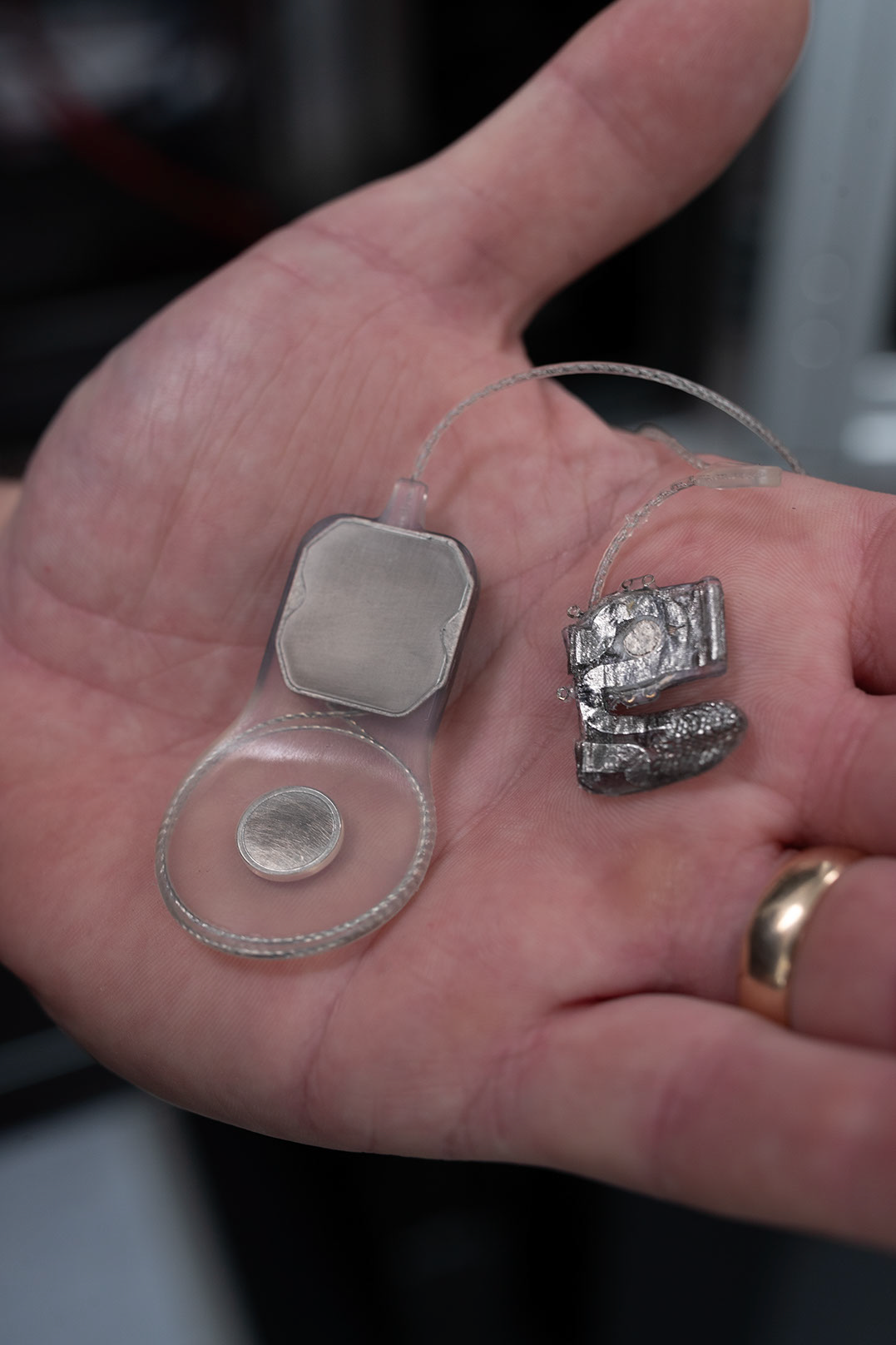 The bionic eye device.