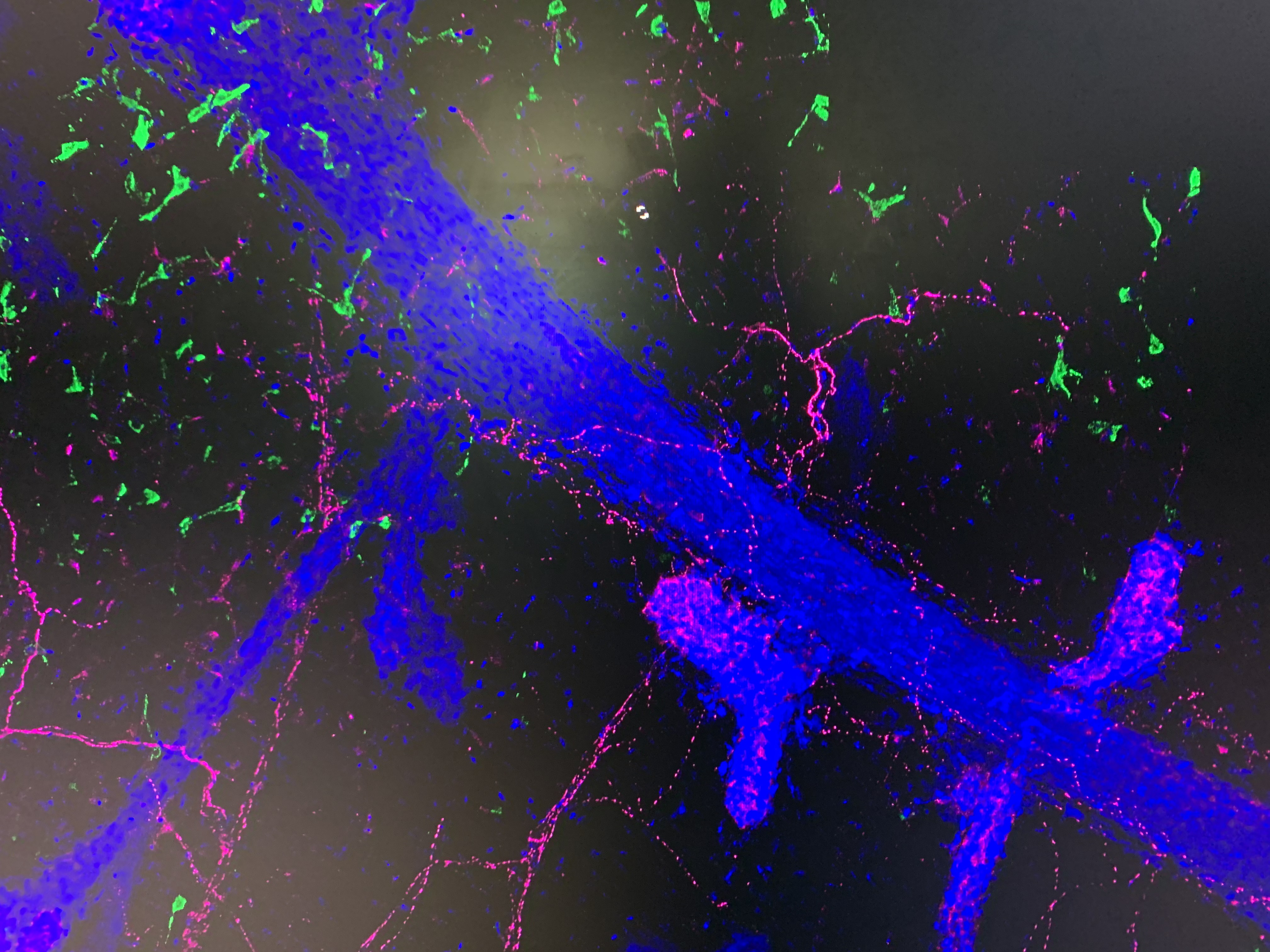 Nerve image, supplied by Monash University