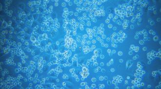 Booster shot being developed to avoid recapturing koalas to fight Chlamydia 